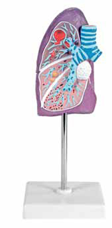 Pathological Model of the Lung